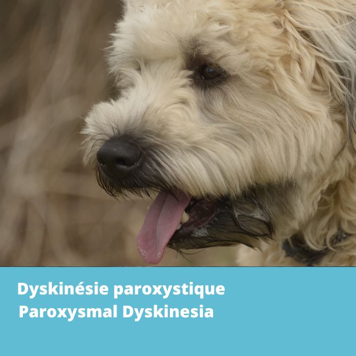 Dyskinésie paroxystique (PxD, gène PIGN)