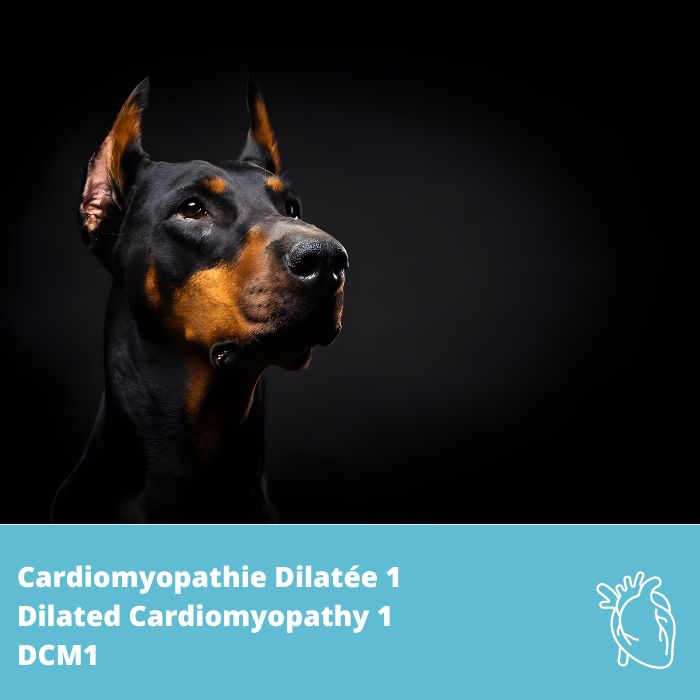 Cardiomyopathie Dilatée 1 (DCM1- PDK4) 