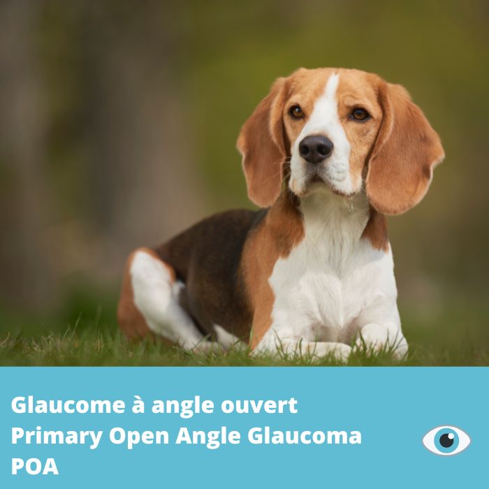 Glaucome à angle ouvert (POA) gène Adamts10