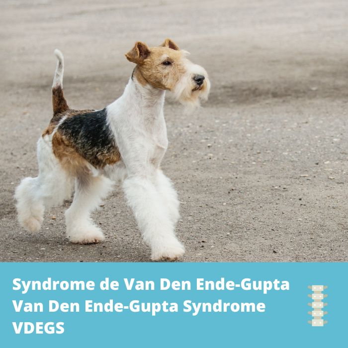 Syndrome de Van Den Ende-Gupta (VDEGS, Scarf2)